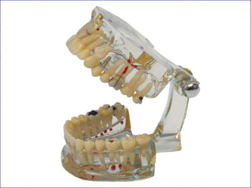 Studienmodell Transparent Plus – Hager & Werken, Die & Model Materials