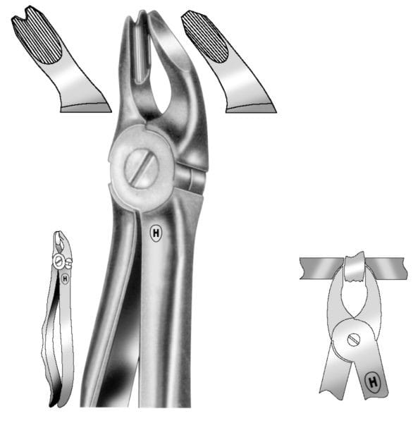 HSA 234-17, Spezial-Zahnzange – Karl Hammacher, Extraction Forceps Upper Jaw