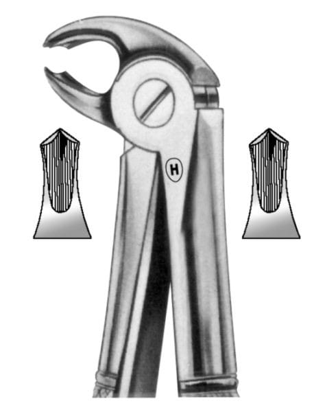 HSA 331-22, Zahnzange – Karl Hammacher, Pediatric Extraction Forceps
