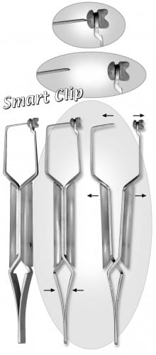 HSC 518-14, Smart Clip – Karl Hammacher, Sonstige Zahntechnikinstrumente