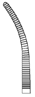 HSE 065-14, Arterienklemme