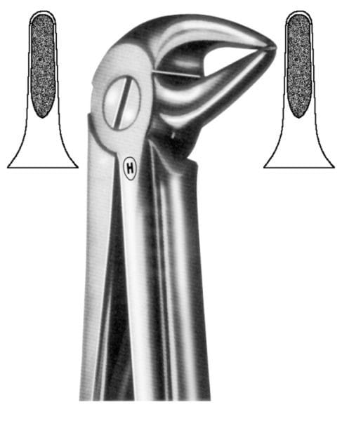 HSA 292-33, Zahnzange – Karl Hammacher, Extraction Forceps Lower Jaw