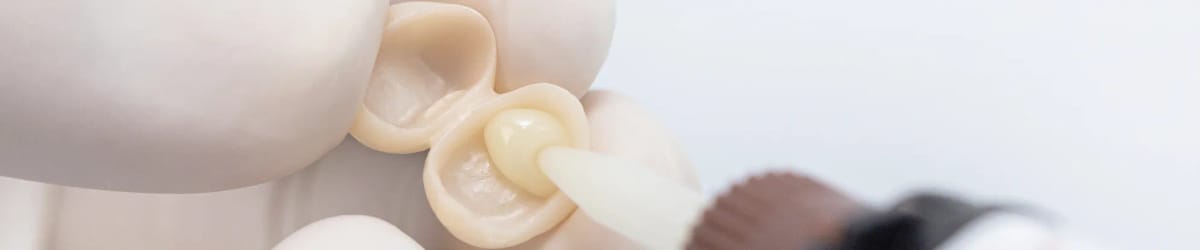 Dental Adhesive Resin Cement Solution – Shandong Huge Dental Material Corporation, Zemente