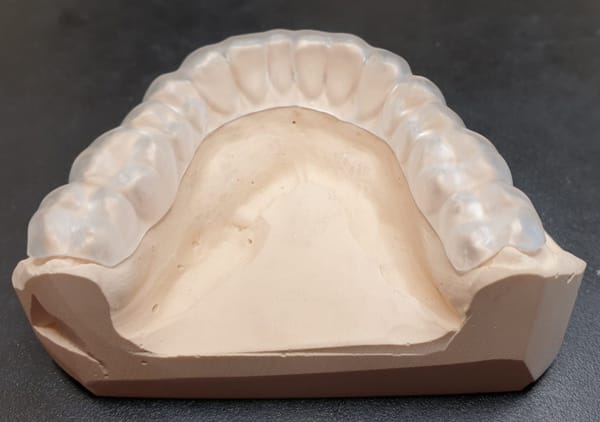 i-PD Splint