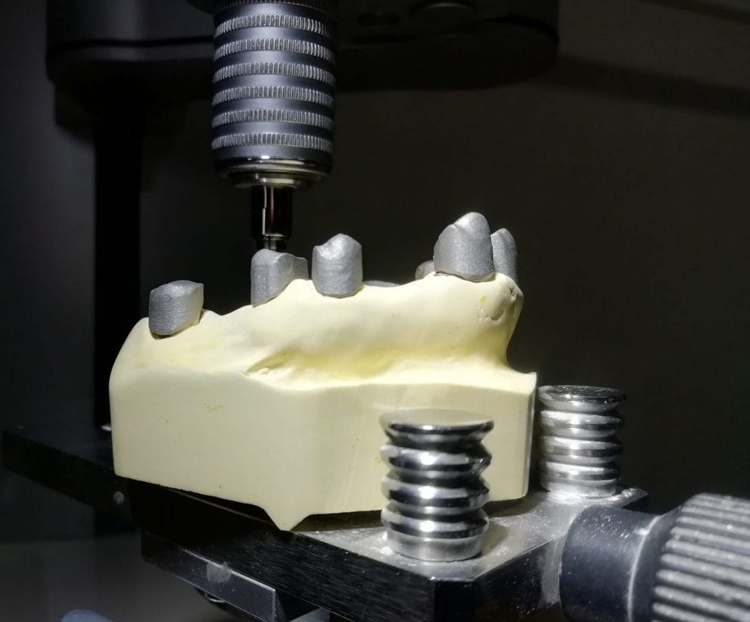 i-PD Teleskopprothetik mit CoCr SLM – i-ProDens GmbH, Denture Resins