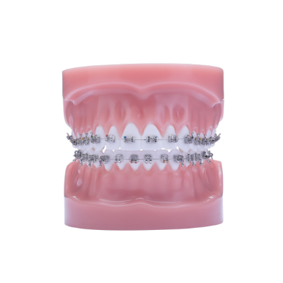 Majestic Typodonte - Pièce – IOS International Orthodontic Services, Intraoral Appliances