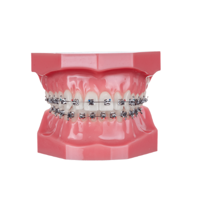 Pactive Typodont - Piece – IOS International Orthodontic Services, Intraoral Appliances