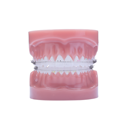 Phantom LP Typodont - Einzelzahn – IOS International Orthodontic Services, Brackets & Tubes