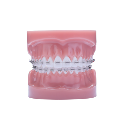 Phantom Plus Typodont - Stück – IOS International Orthodontic Services, Brackets & Tubes