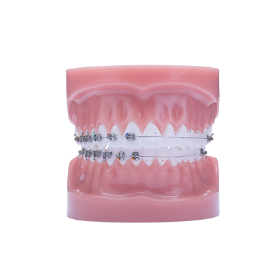 Majestic &amp; Phantom Typodonte - Pièce – IOS International Orthodontic Services, Intraoral Appliances