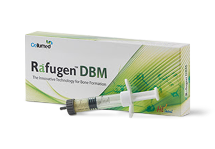 Rafugen DBM Putty