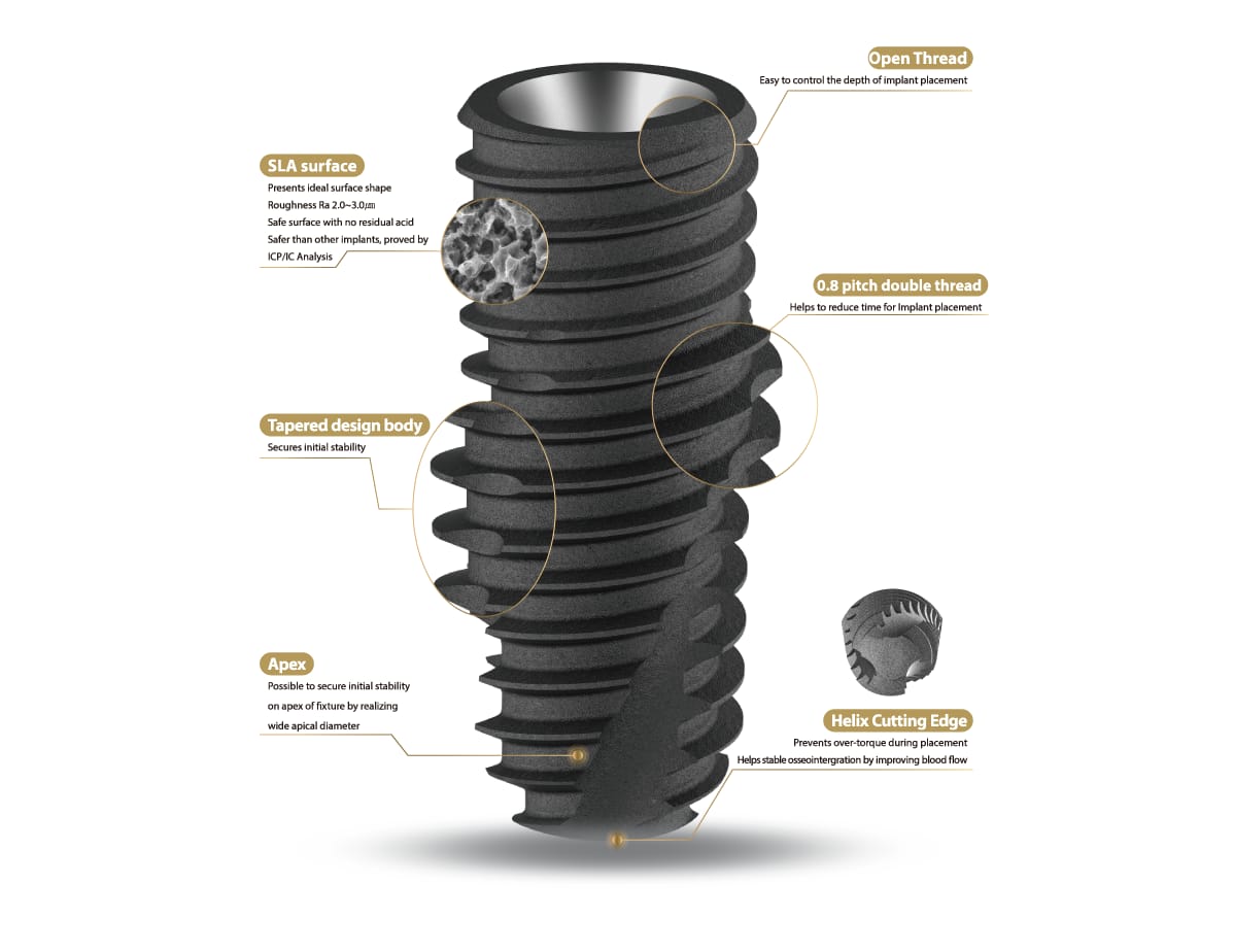 R-System – IZEN IMPLANT CO., LTD., Implants