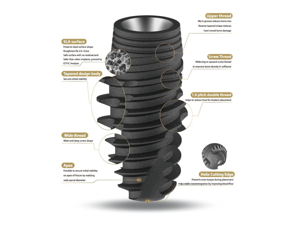 ZENEX Plus System T-System – IZEN IMPLANT CO., LTD., Implants