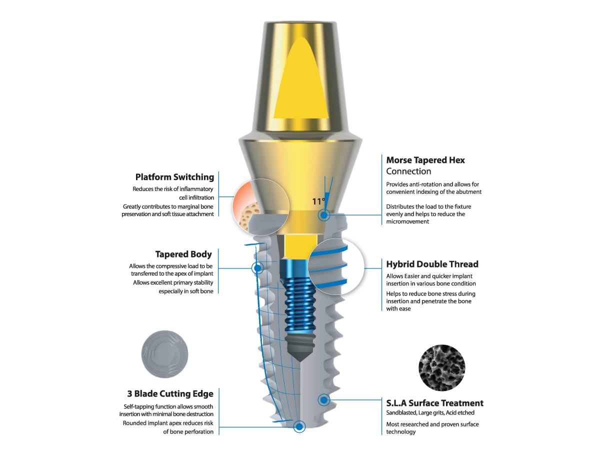 Połączenie niebieskie – IZEN IMPLANT CO., LTD., Abutments