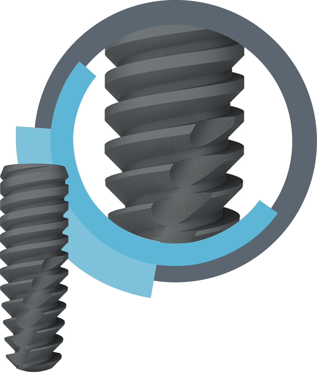 S-Fix – Kamal Encon Industries Ltd, Implant Systems