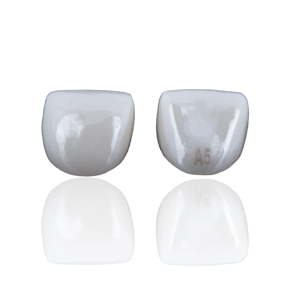 Recharges d'incisives – Kids-e-Dental LLP, Preformed Crowns