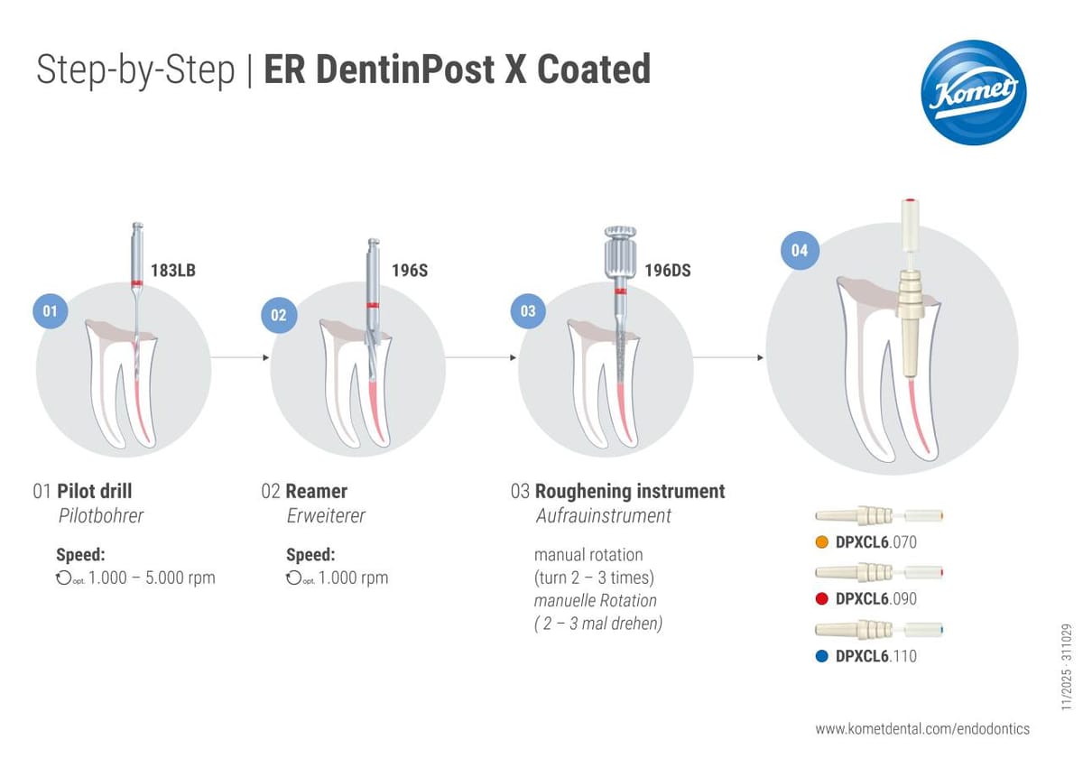 Step by Step | ER DentinPost X Coated – Komet Dental, Stiftsysteme