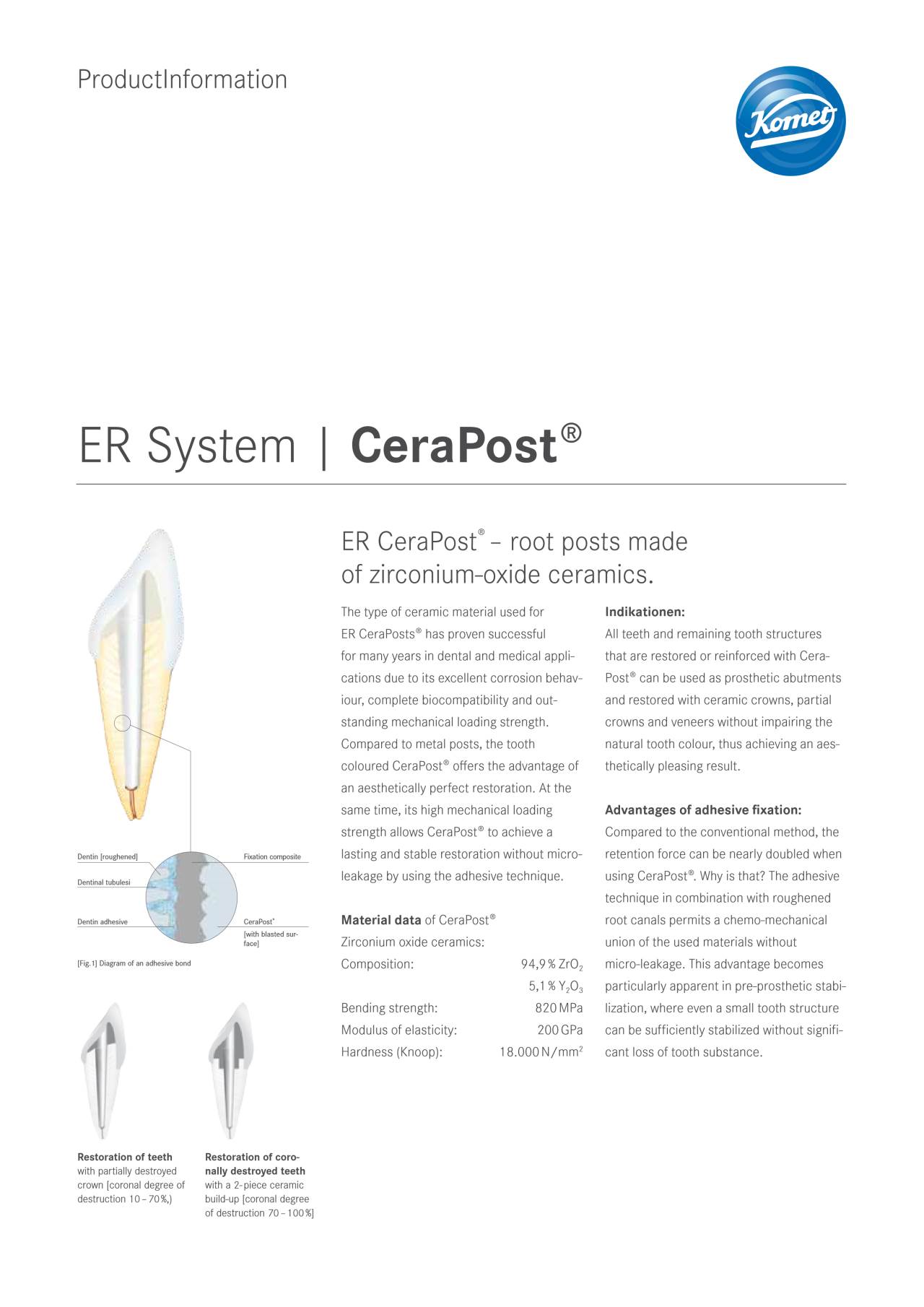 PI | CeraPost® – Komet Dental, Post Systems