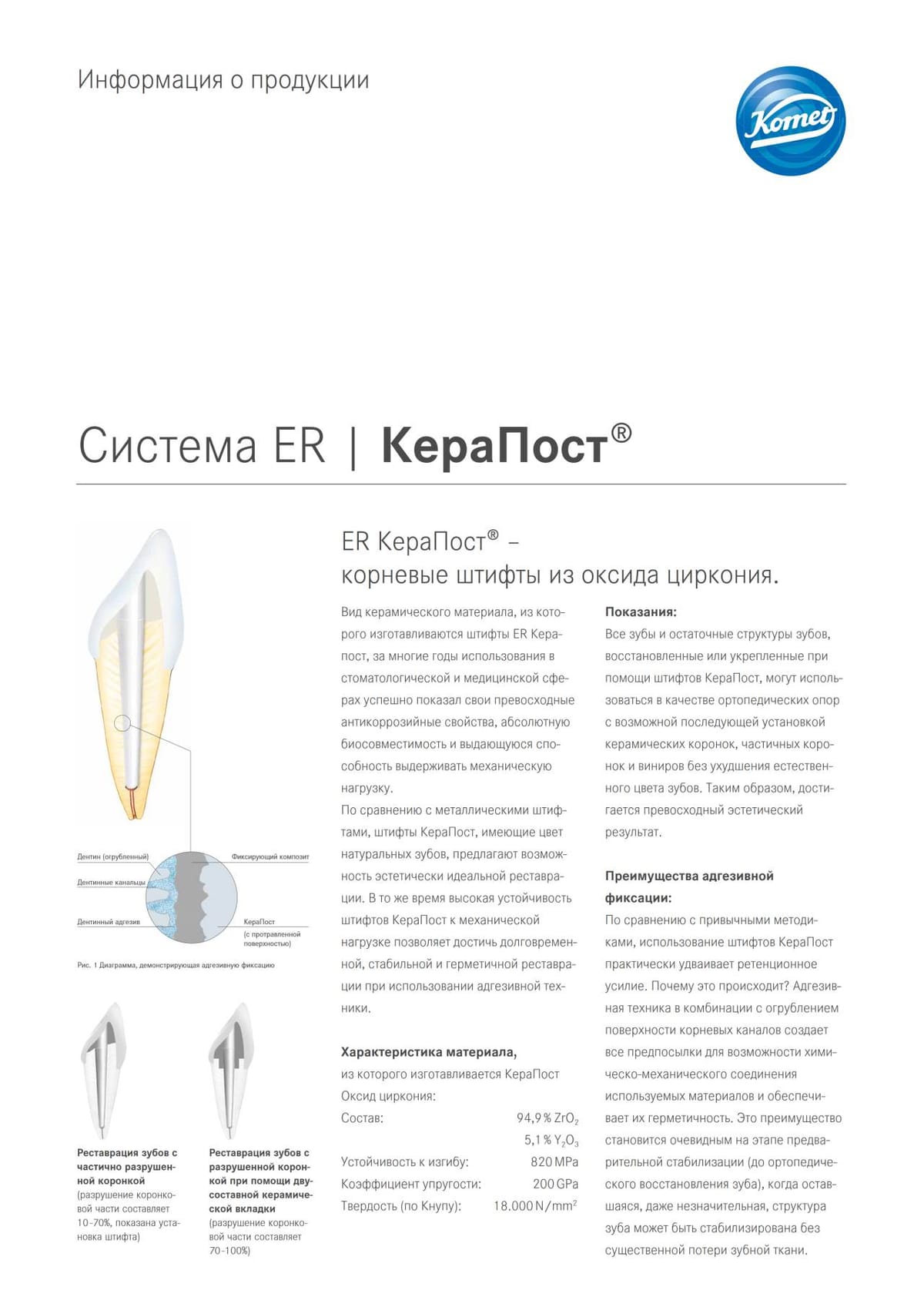 PI | КераПост® – Komet Dental, Stiftsysteme