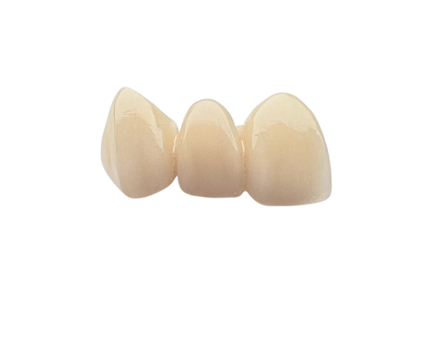 Layered Zirconia – League Dental Laboratory, Ceramic Materials
