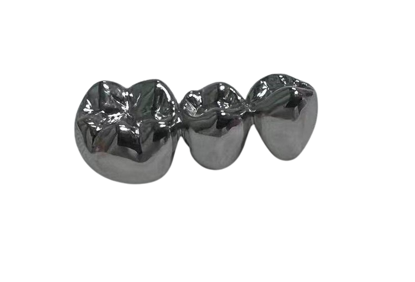 Full Metal/Gold Crown – League Dental Laboratory, Provisorische Kronen