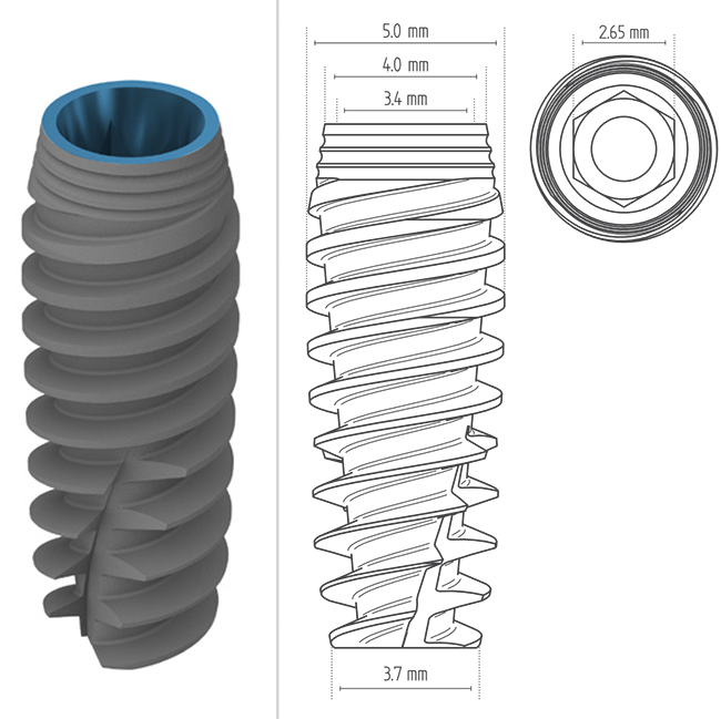 Fix Konisch WD 5.0 – Medigma Biomedical GmbH, Implantate