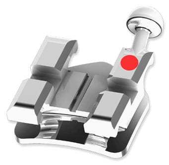 Kieferorthopädisches Metallbracket – Modern Orthodontics, Kieferorthopädie