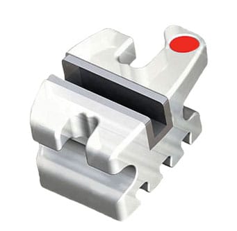 Kieferorthopädisches Keramikbracket mit Metallslot – Modern Orthodontics, Brackets