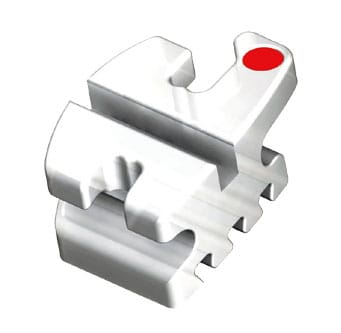 Elegant Composite – Modern Orthodontics, Brackets