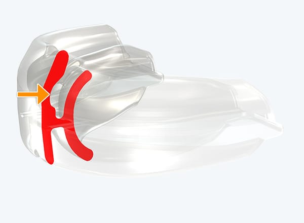 Trainer for Braces Phase 2