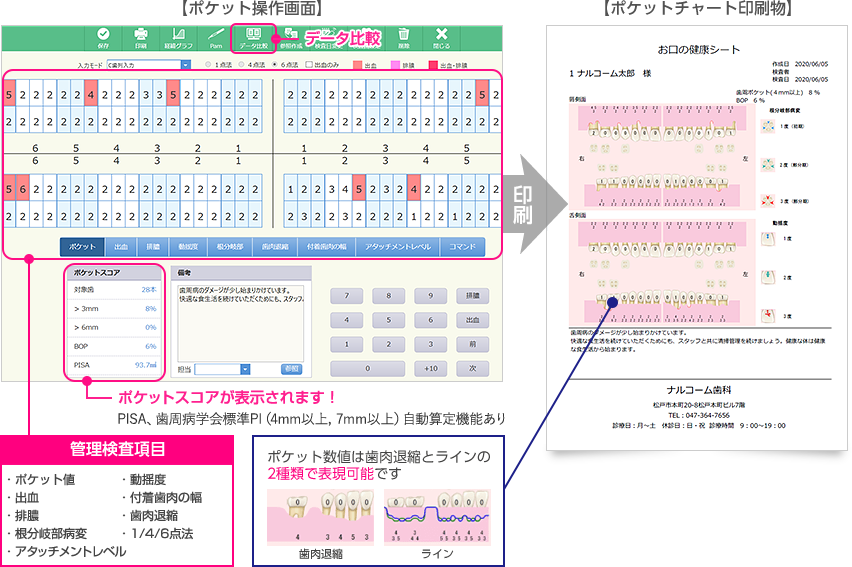 Tatsujin Plus – Narcohm Co., Ltd., Periodontal Diagnostics
