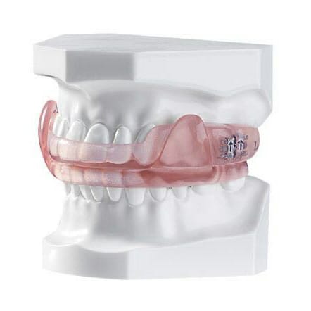 Fin Anti-snorning Guard