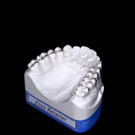 Essix Retainer – New Perfect Dental Lab, Orthodontics