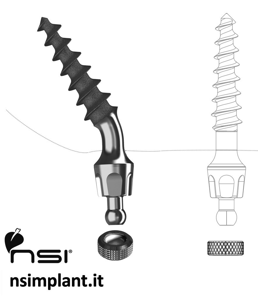 Maxifix Compressive P – NSI srl, Implant Systems