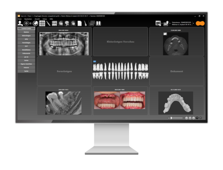 byzz® Nxt – orangedental, CAD/CAM Software