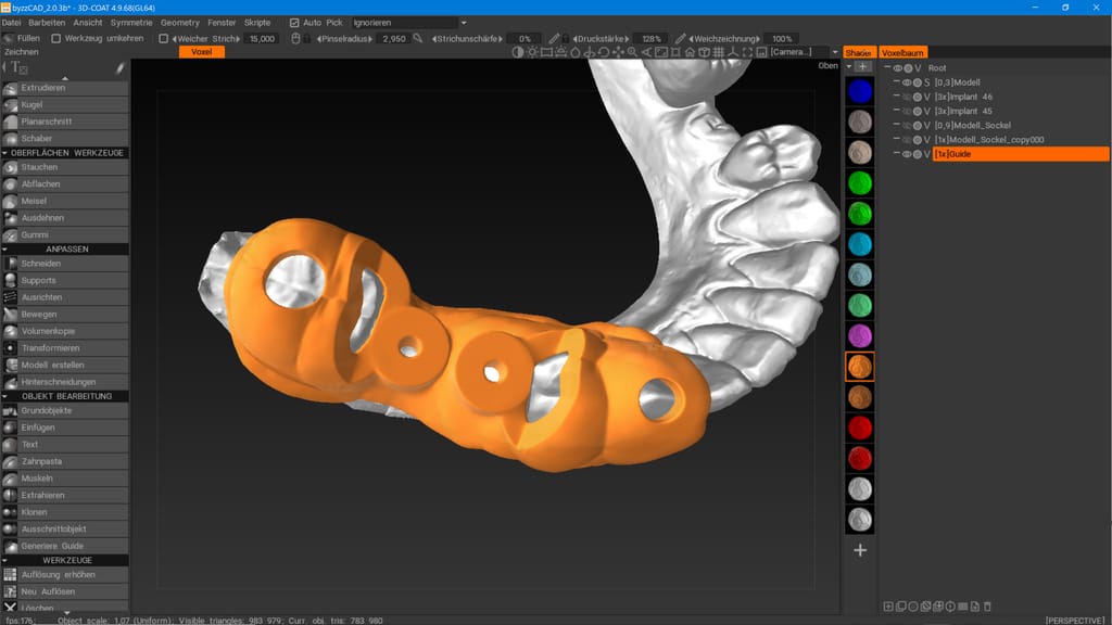 byzz® CAD – orangedental, CAD/CAM-Software