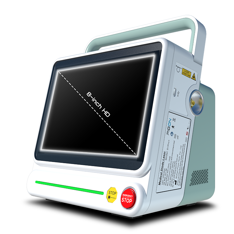 Dual-Wavelength Optimal Configuration – Wuhan Pioon Tech. Co.,Ltd., Equipment