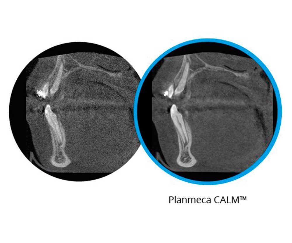 Planmeca ProMax® 3D Max