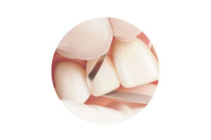 Two Striper® Diamond Finishing Strips – Premier Dental, Polishing Strips & Abrasive Strips