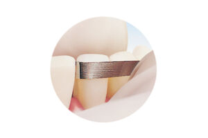 Two Striper® 200T2 – Premier Dental, Polishing Strips & Abrasive Strips