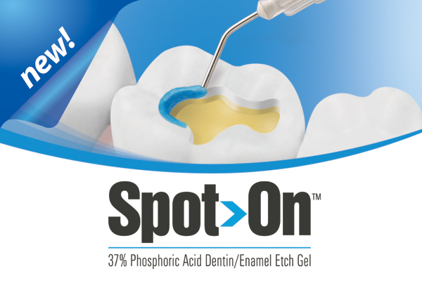Spot-On™ Etch – Premier Dental, Etchants & Primers