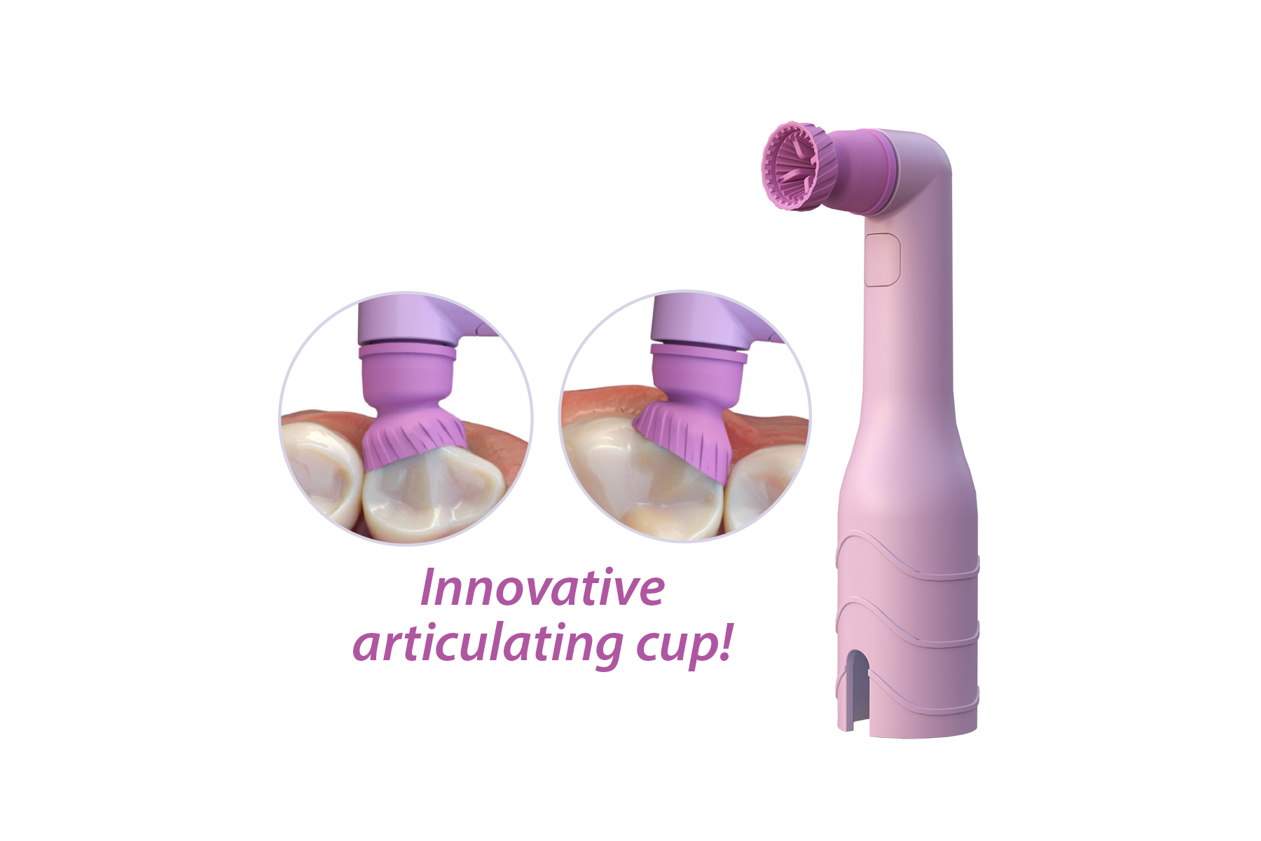 ProFlare™ – Premier Dental, Prophy Angles