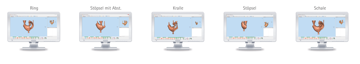 CYFEX - CAD/CAM Software für Profis – pro3dure medical, CAD/CAM Software