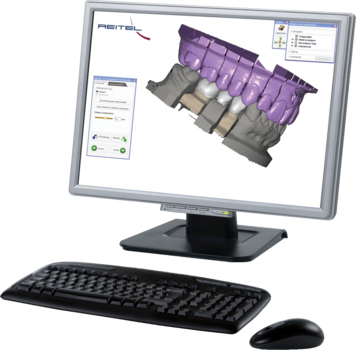 Exocad® Design Software Implant Ultimate Package – REITEL Feinwerktechnik, CAD/CAM Software