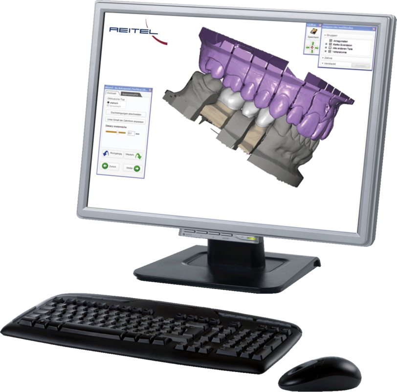 Exocad® Design Software Advanced Lab Package – REITEL Feinwerktechnik, CAD/CAM-Software
