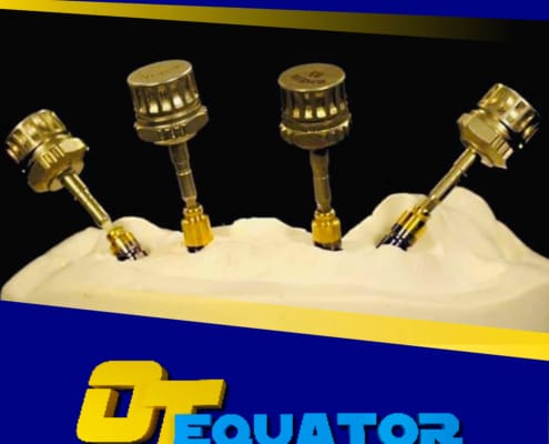 OT EQUATOR ABUTMENT