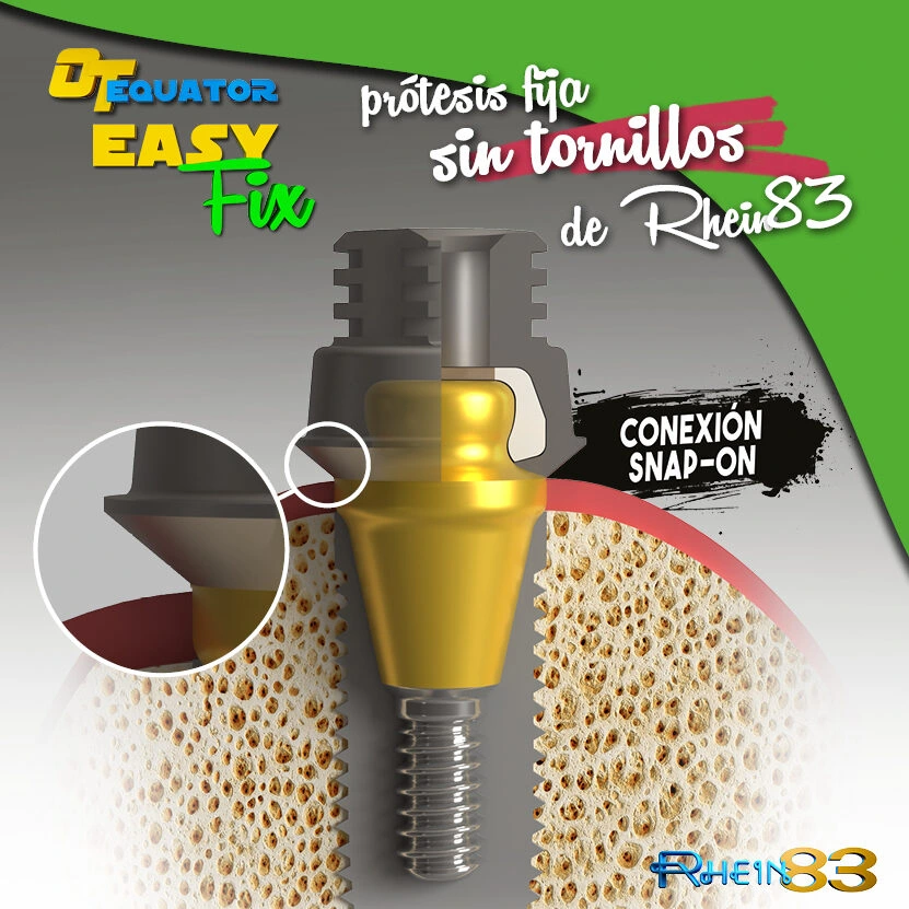 OT EQUATOR EASY FIX – Rhein 83 S.R.L., Implant Components & Abutments