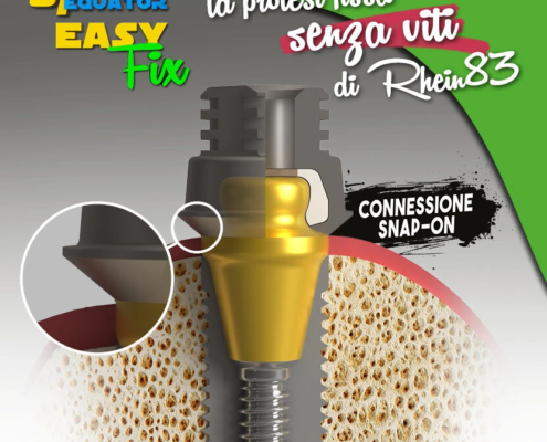 EASY FIX – Rhein 83 S.R.L., Implant Components & Abutments