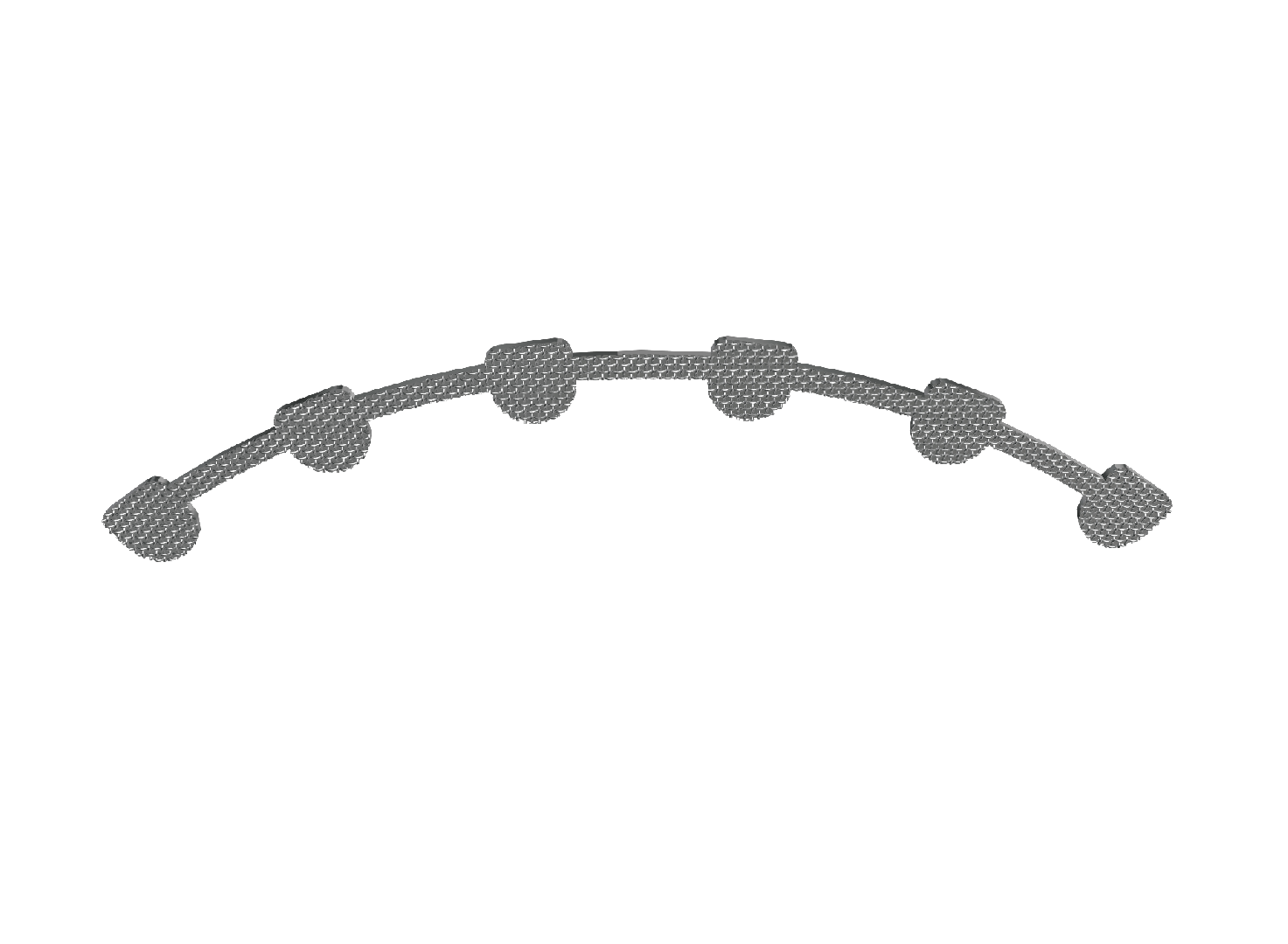 Lingual Retainer – Zhejiang Risheng Medical Technology Co ., Retainers