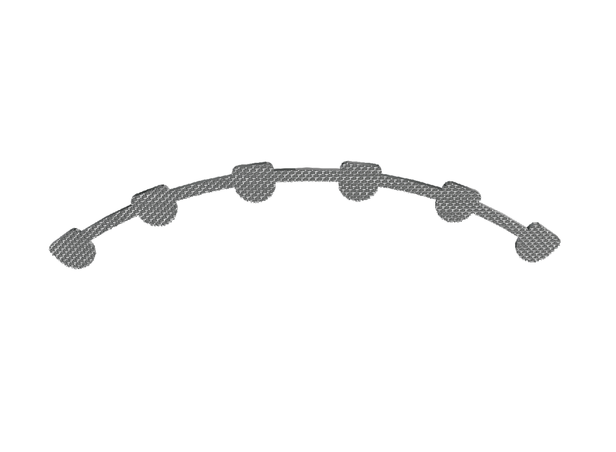 Lingual Retainer – Zhejiang Risheng Medical Technology Co ., Kieferorthopädie